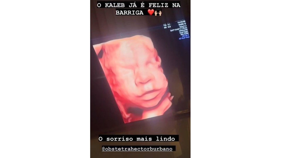 Imagem da Galeria