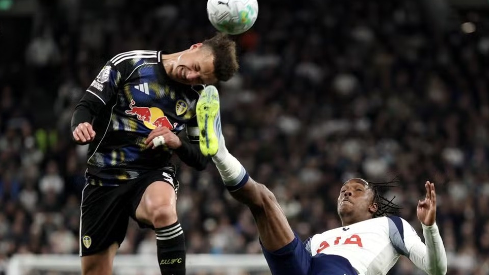 Volante do Leeds mostra ferimento na testa após receber chute de atacante do Tottenham